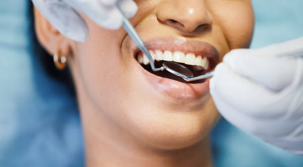 Best Knocked-Out Tooth (Avulsed Tooth) Treatment in Doe Valley, KY